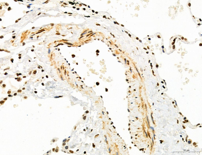 OGDH Antibody in Immunohistochemistry (Paraffin) (IHC (P))