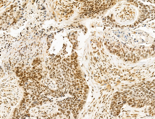 OGDH Antibody in Immunohistochemistry (Paraffin) (IHC (P))