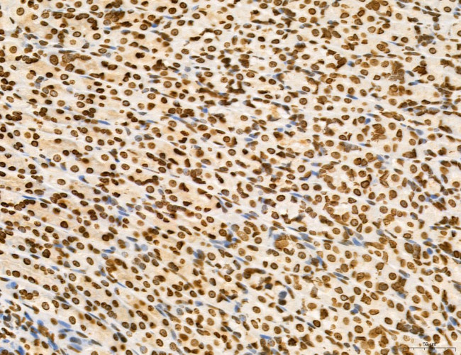 OGDH Antibody in Immunohistochemistry (Paraffin) (IHC (P))