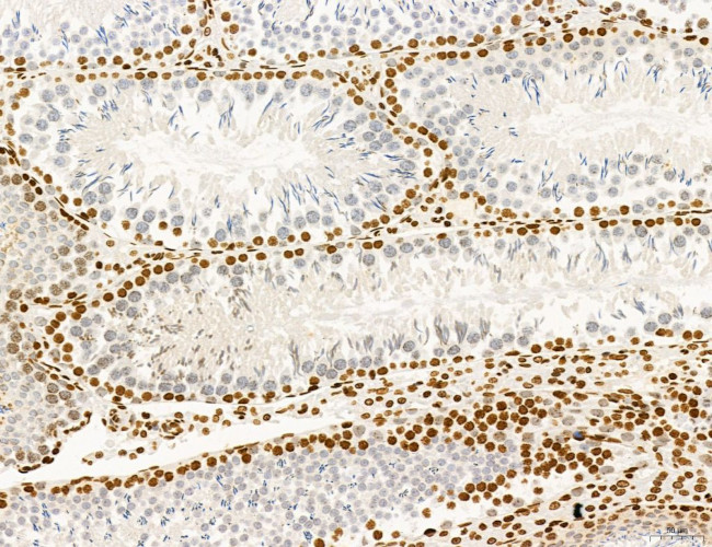 OGDH Antibody in Immunohistochemistry (Paraffin) (IHC (P))