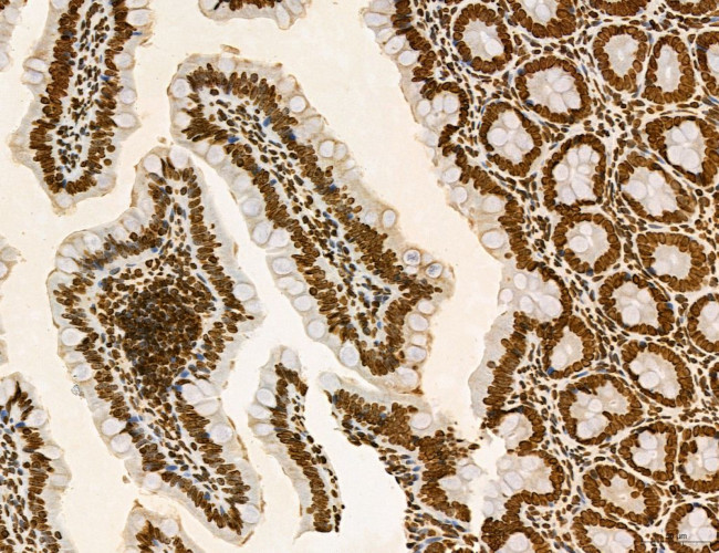 OGDH Antibody in Immunohistochemistry (Paraffin) (IHC (P))