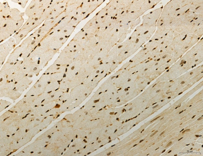 OGDH Antibody in Immunohistochemistry (Paraffin) (IHC (P))