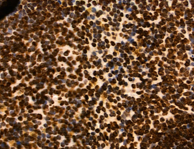 OGDH Antibody in Immunohistochemistry (Paraffin) (IHC (P))