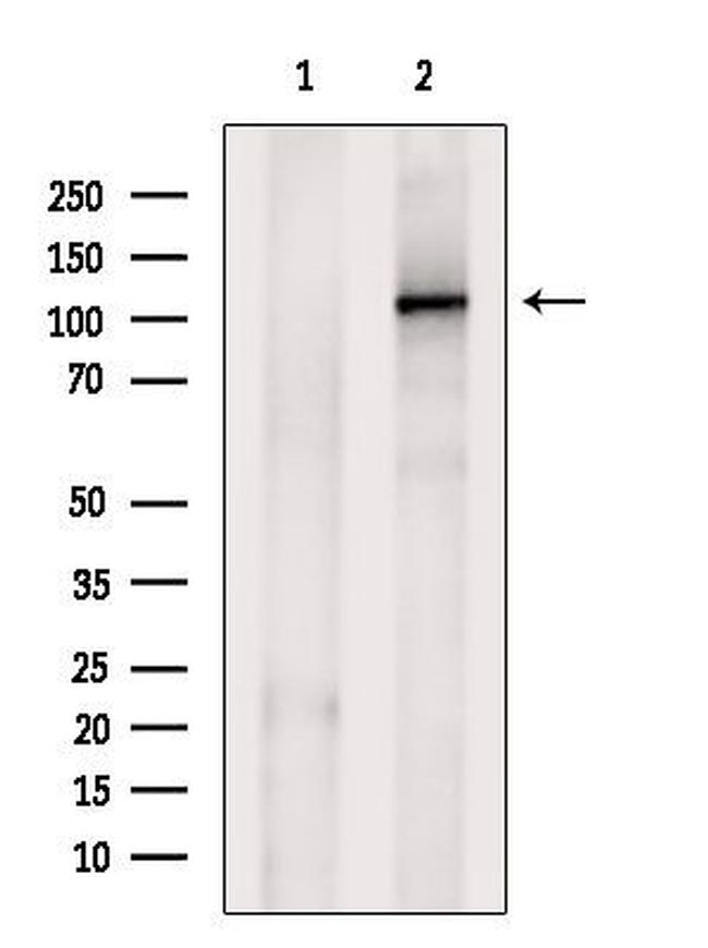 OGDH Antibody in Western Blot (WB)