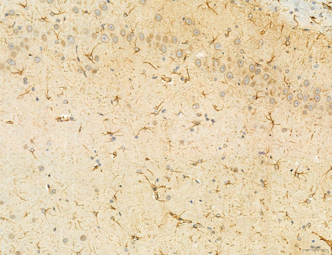 SEC61G Antibody in Immunohistochemistry (Paraffin) (IHC (P))