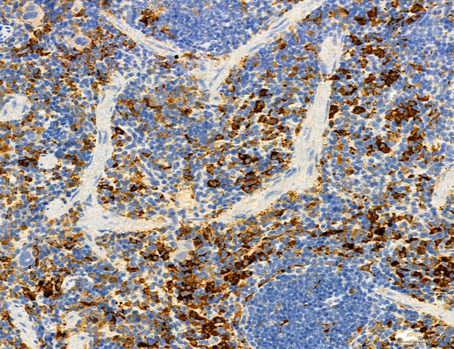 SEC61G Antibody in Immunohistochemistry (Paraffin) (IHC (P))