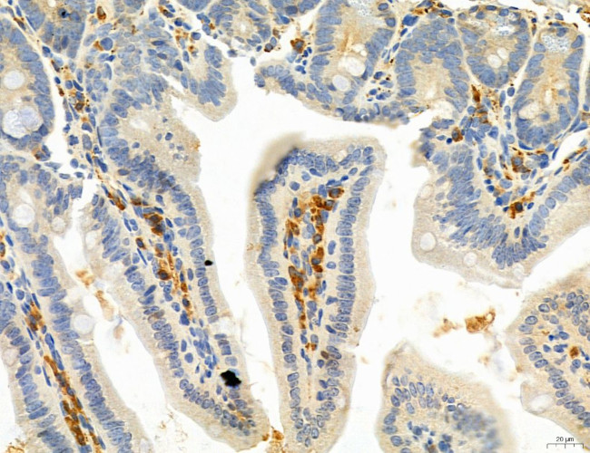 SEC61G Antibody in Immunohistochemistry (Paraffin) (IHC (P))