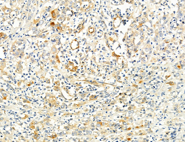 SEC61G Antibody in Immunohistochemistry (Paraffin) (IHC (P))