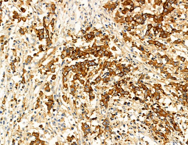 SEC61G Antibody in Immunohistochemistry (Paraffin) (IHC (P))