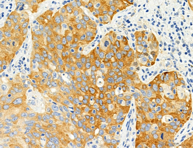 SEC61G Antibody in Immunohistochemistry (Paraffin) (IHC (P))