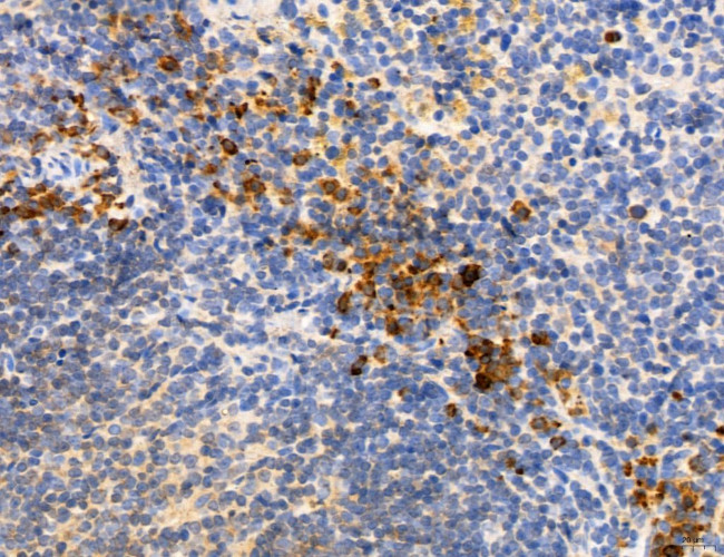 CHMP2A Antibody in Immunohistochemistry (Paraffin) (IHC (P))