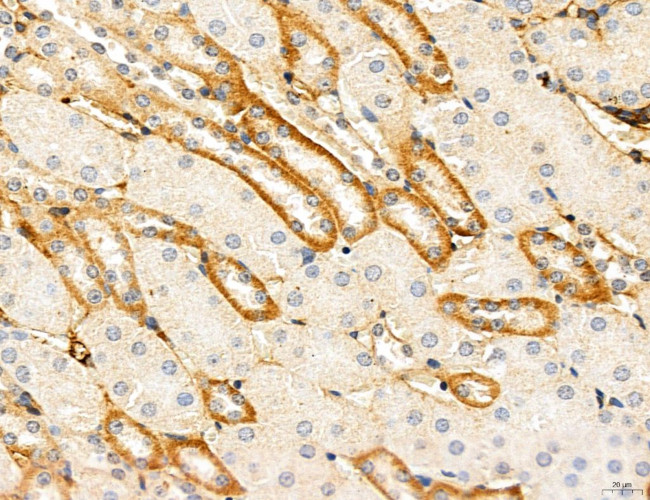 CHMP2A Antibody in Immunohistochemistry (Paraffin) (IHC (P))