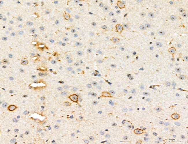 CHMP2A Antibody in Immunohistochemistry (Paraffin) (IHC (P))