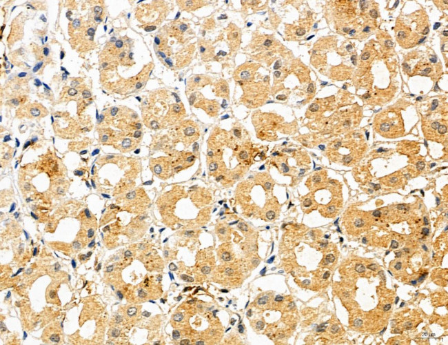 CHMP2A Antibody in Immunohistochemistry (Paraffin) (IHC (P))