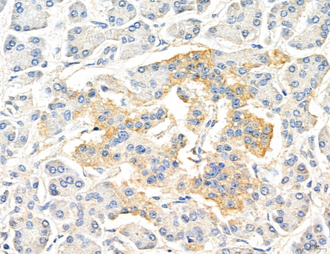 CHMP2A Antibody in Immunohistochemistry (Paraffin) (IHC (P))