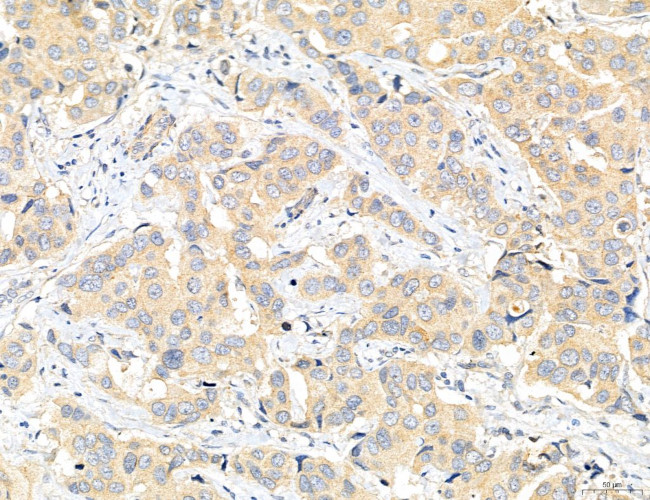 CHMP2A Antibody in Immunohistochemistry (Paraffin) (IHC (P))