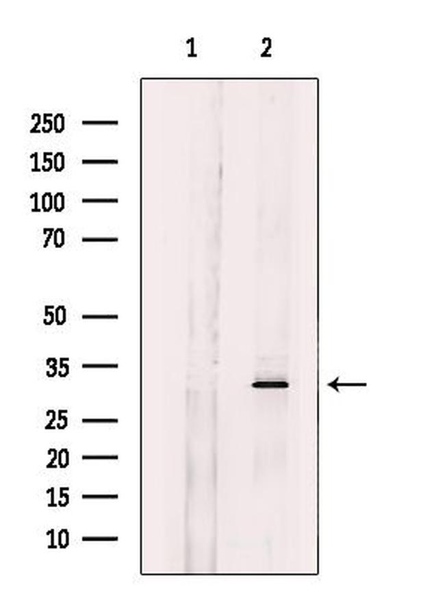 CHMP2A Antibody in Western Blot (WB)