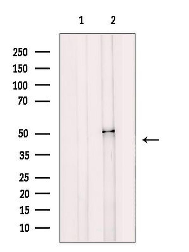 MAGT1 Antibody in Western Blot (WB)