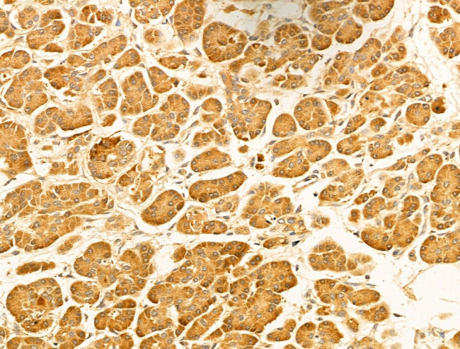 MICAL1 Antibody in Immunohistochemistry (Paraffin) (IHC (P))