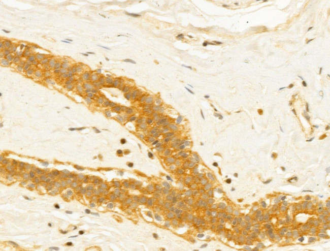 MICAL1 Antibody in Immunohistochemistry (Paraffin) (IHC (P))