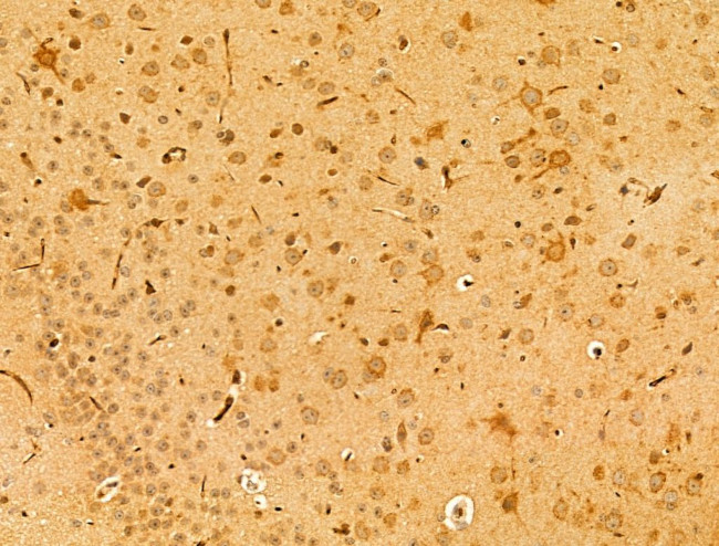 PEX16 Antibody in Immunohistochemistry (Paraffin) (IHC (P))