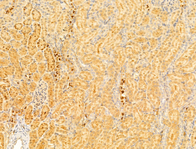 PEX16 Antibody in Immunohistochemistry (Paraffin) (IHC (P))