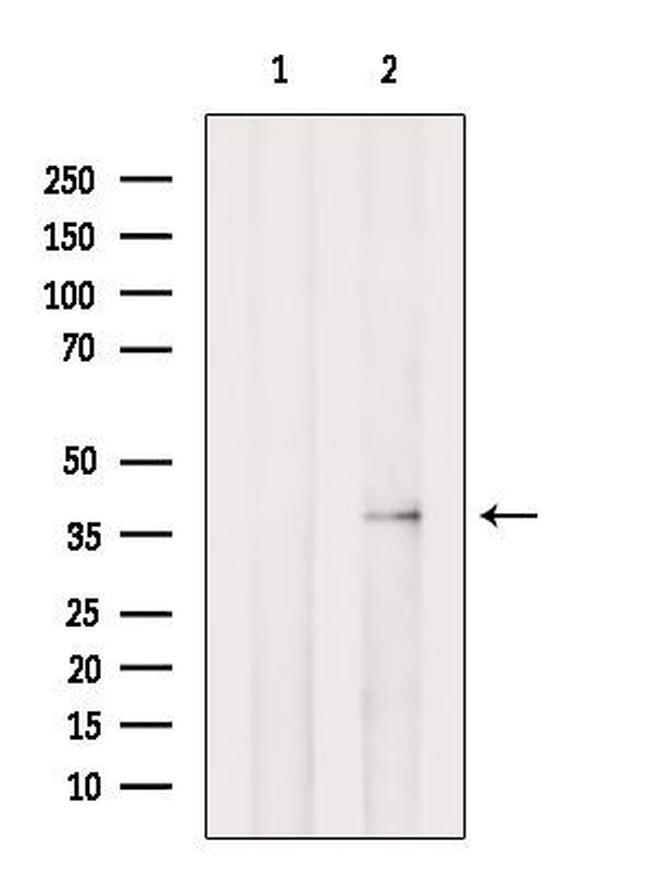 PEX16 Antibody in Western Blot (WB)