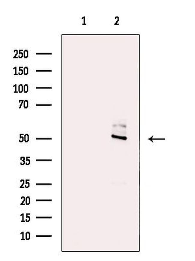 SNX17 Antibody in Western Blot (WB)