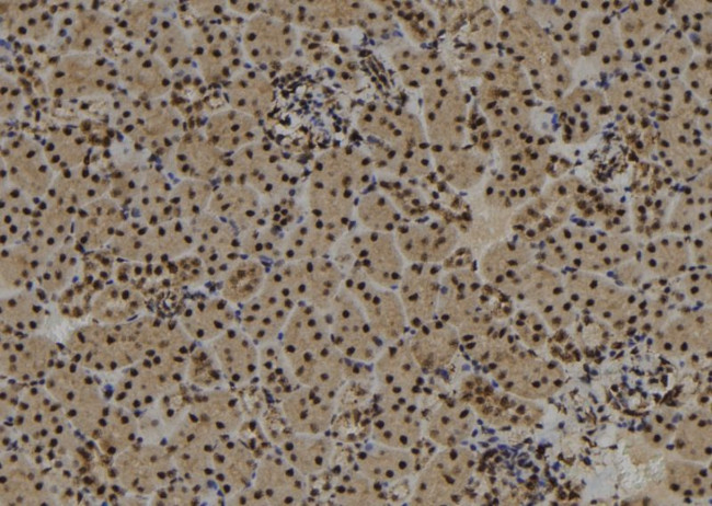 SYNPO2 Antibody in Immunohistochemistry (Paraffin) (IHC (P))