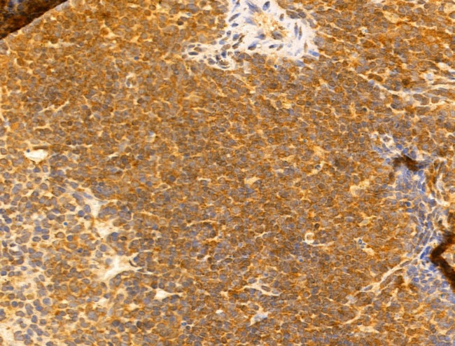 SYNPO2 Antibody in Immunohistochemistry (Paraffin) (IHC (P))