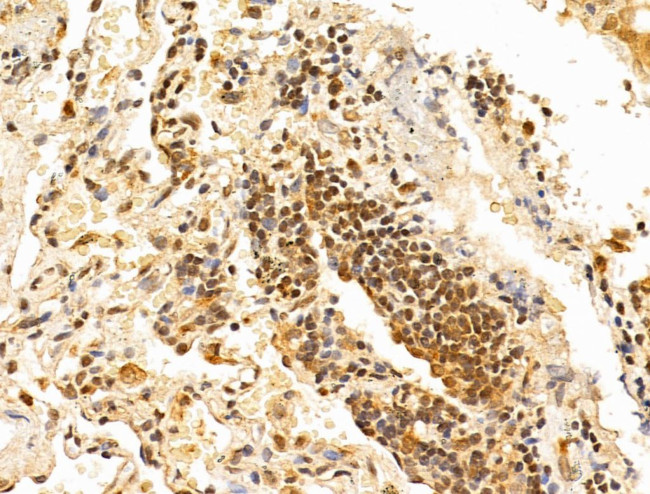 TAF12 Antibody in Immunohistochemistry (Paraffin) (IHC (P))