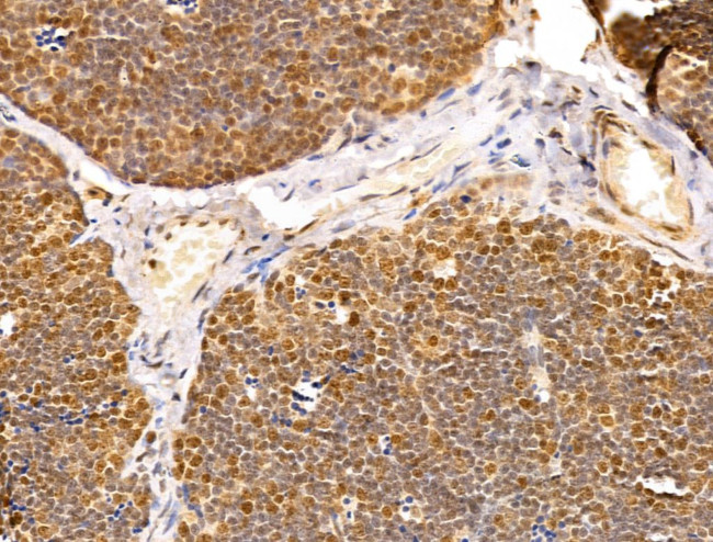 TAF12 Antibody in Immunohistochemistry (Paraffin) (IHC (P))