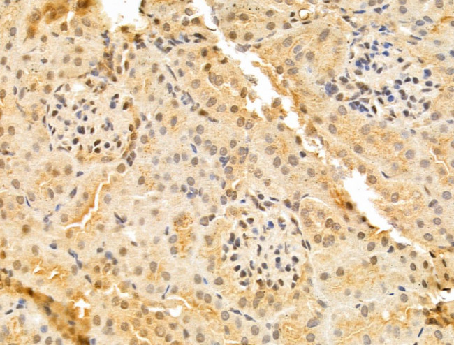 TAF12 Antibody in Immunohistochemistry (Paraffin) (IHC (P))