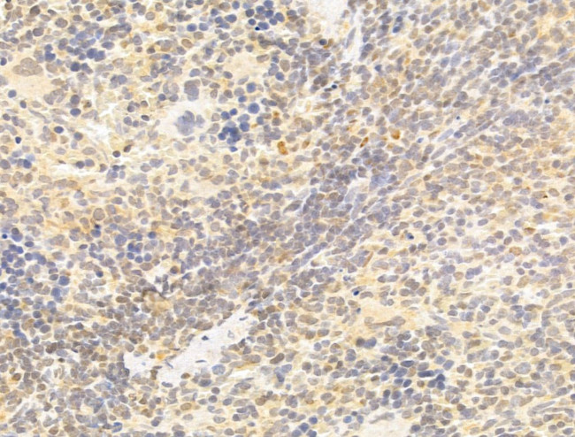 TAF12 Antibody in Immunohistochemistry (Paraffin) (IHC (P))