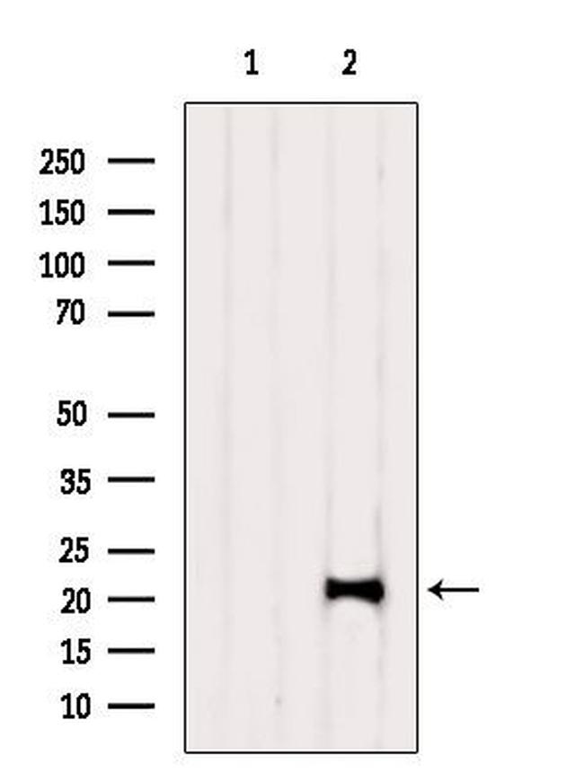 TAF12 Antibody in Western Blot (WB)