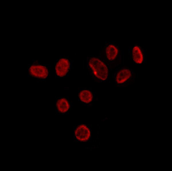 TIA-1 Antibody in Immunocytochemistry (ICC/IF)