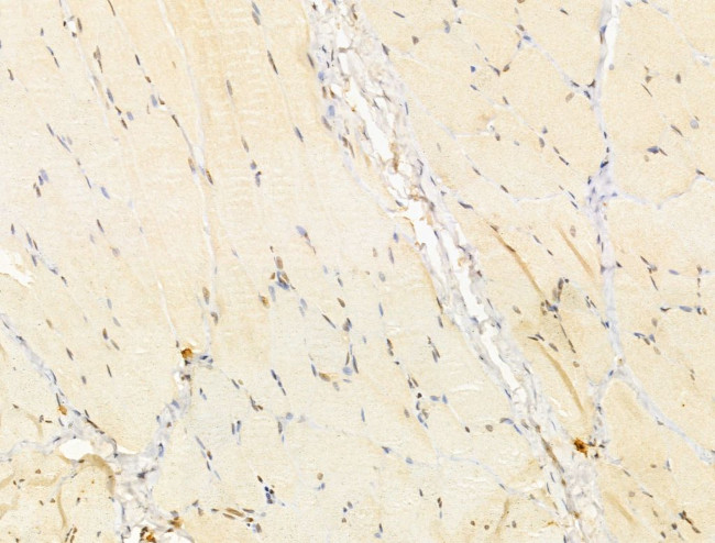 TIA-1 Antibody in Immunohistochemistry (Paraffin) (IHC (P))