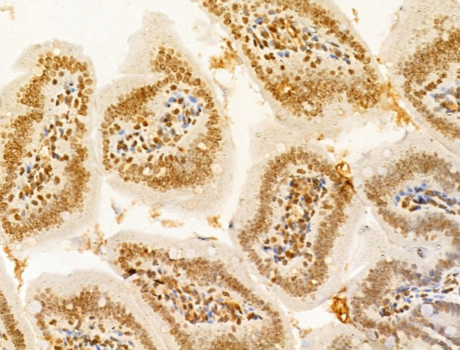 TIA-1 Antibody in Immunohistochemistry (Paraffin) (IHC (P))