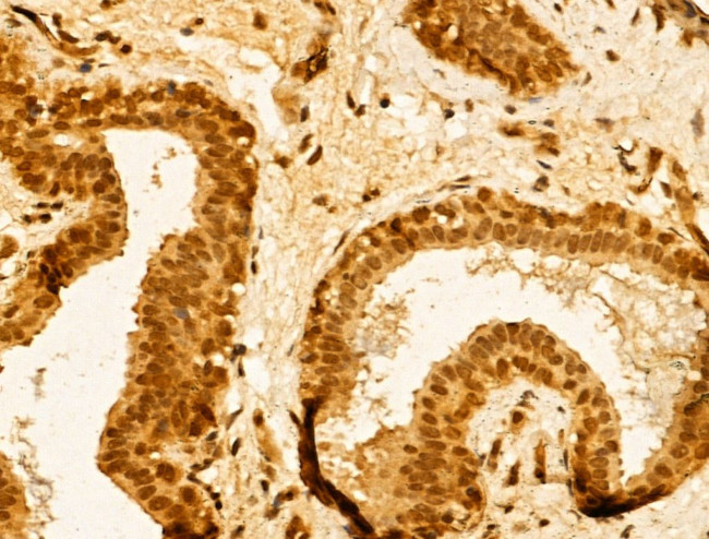 TIA-1 Antibody in Immunohistochemistry (Paraffin) (IHC (P))