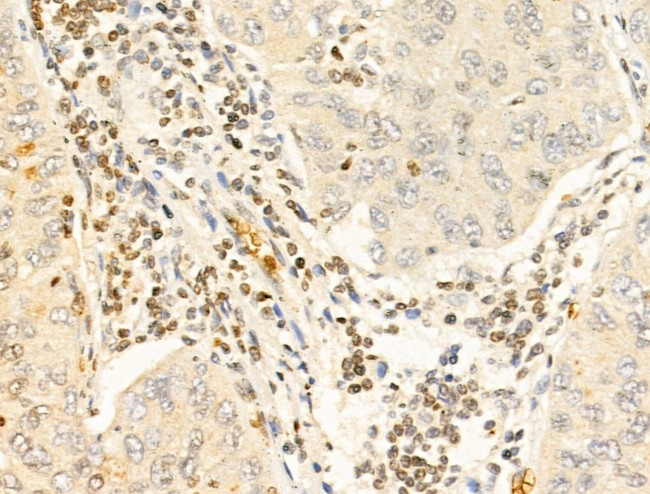 TIA-1 Antibody in Immunohistochemistry (Paraffin) (IHC (P))