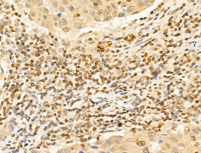 TIA-1 Antibody in Immunohistochemistry (Paraffin) (IHC (P))