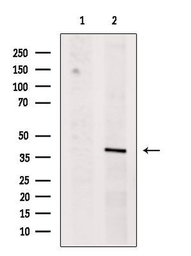 TIA-1 Antibody in Western Blot (WB)