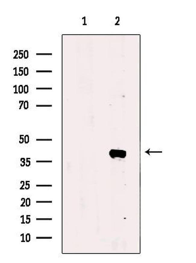 TIA-1 Antibody in Western Blot (WB)