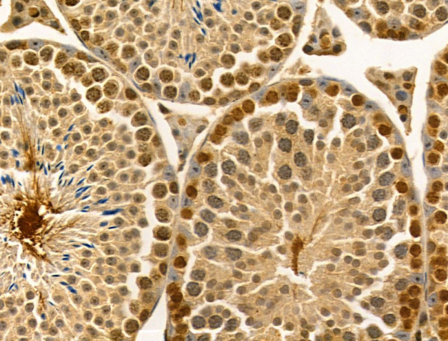 LARP7 Antibody in Immunohistochemistry (Paraffin) (IHC (P))