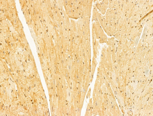 OIP5 Antibody in Immunohistochemistry (Paraffin) (IHC (P))