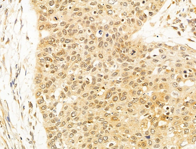 OIP5 Antibody in Immunohistochemistry (Paraffin) (IHC (P))