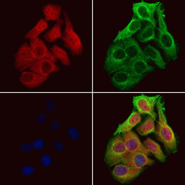 OTUD7B Antibody in Immunocytochemistry (ICC/IF)