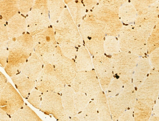 OTUD7B Antibody in Immunohistochemistry (Paraffin) (IHC (P))