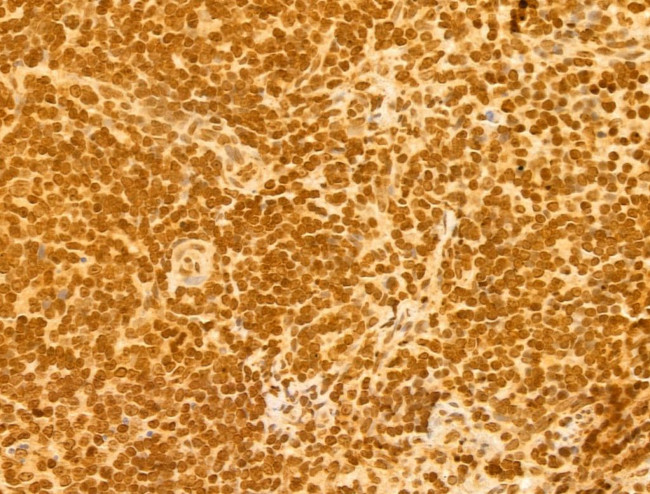 OTUD7B Antibody in Immunohistochemistry (Paraffin) (IHC (P))