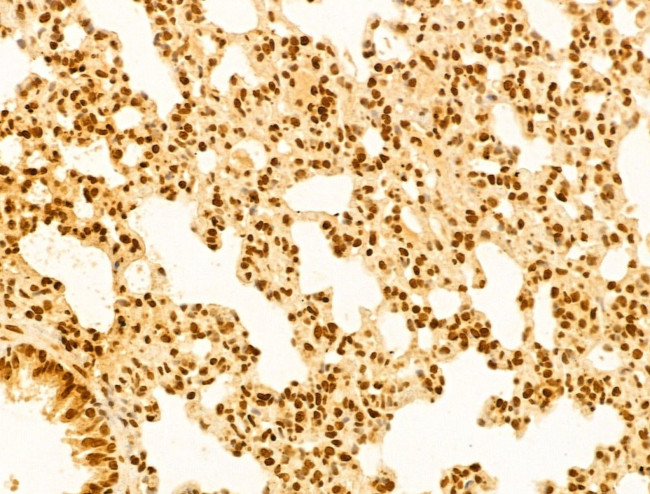 OTUD7B Antibody in Immunohistochemistry (Paraffin) (IHC (P))